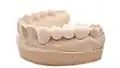 Временный мостовидный протез полученный путем 3D-печати по технологии LCD стереолитографии из фотополимера  HARZ Labs Dental Sand A1-A2