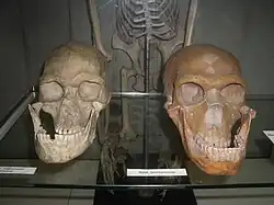 Надбровья и глазницы современного человека (слева) как правило угловатые и «домиком»