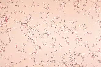 Alcaligenes faecalis, окраска по методу Грама