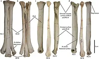 Плюсневые кости MPC-D 100/130