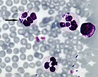Anaplasma phagocytophilum