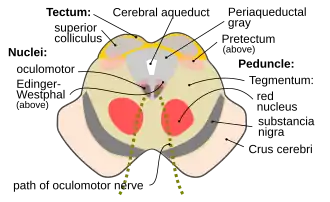 Поперечный разрез среднего мозга с указанием местоположения красного ядра. В верхней части изображения находятся четверохолмие и ножка среднего мозга, отчётливо видны водопровод среднего мозга, чёрная субстанция и ядро глазодвигательного нерва.