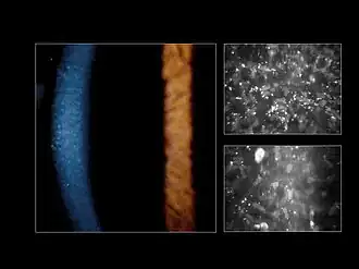 Осмотр роговицы на щелевой лампе (слева) и с помощью конфокальной микроскопии (справа). (Снято доктором Charles N. McGhee)