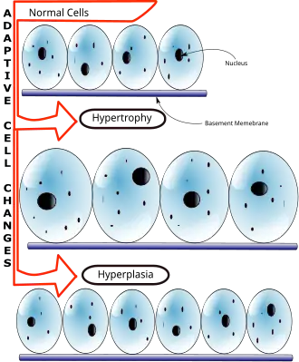 Сравнение нормального состояния клеток, гипертрофии и гиперплазии.