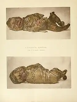 Девочка, 1888 год