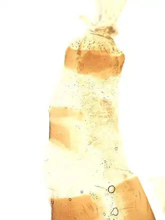 Гениталии самки