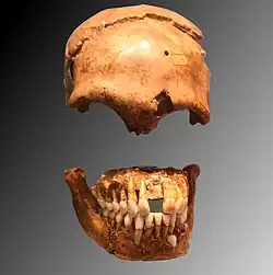 Photo d'un crâne, pris de face et de trois-quart face.