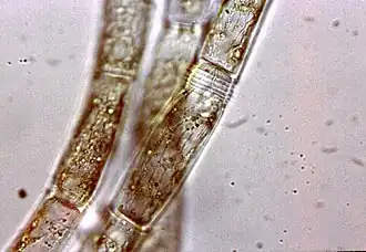 Эдогониум (Oedogonium)