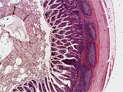 Пейеровы бляшки