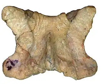 Туловищный позвонок, вид сверху