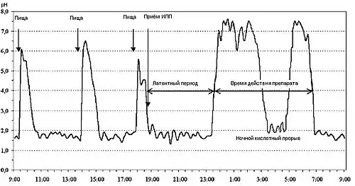 pH-грамма желудка при подборе ингибиторов протонной помпы