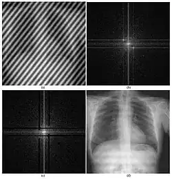 An example of how image processing can be applied to radiography.
