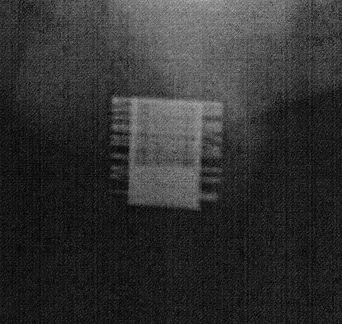 Рентгеновское изображение имплантированного ZSI 375. Устройство активировано — пружина разжимается в верхней части цилиндра. Пациент сдерживает мочу.